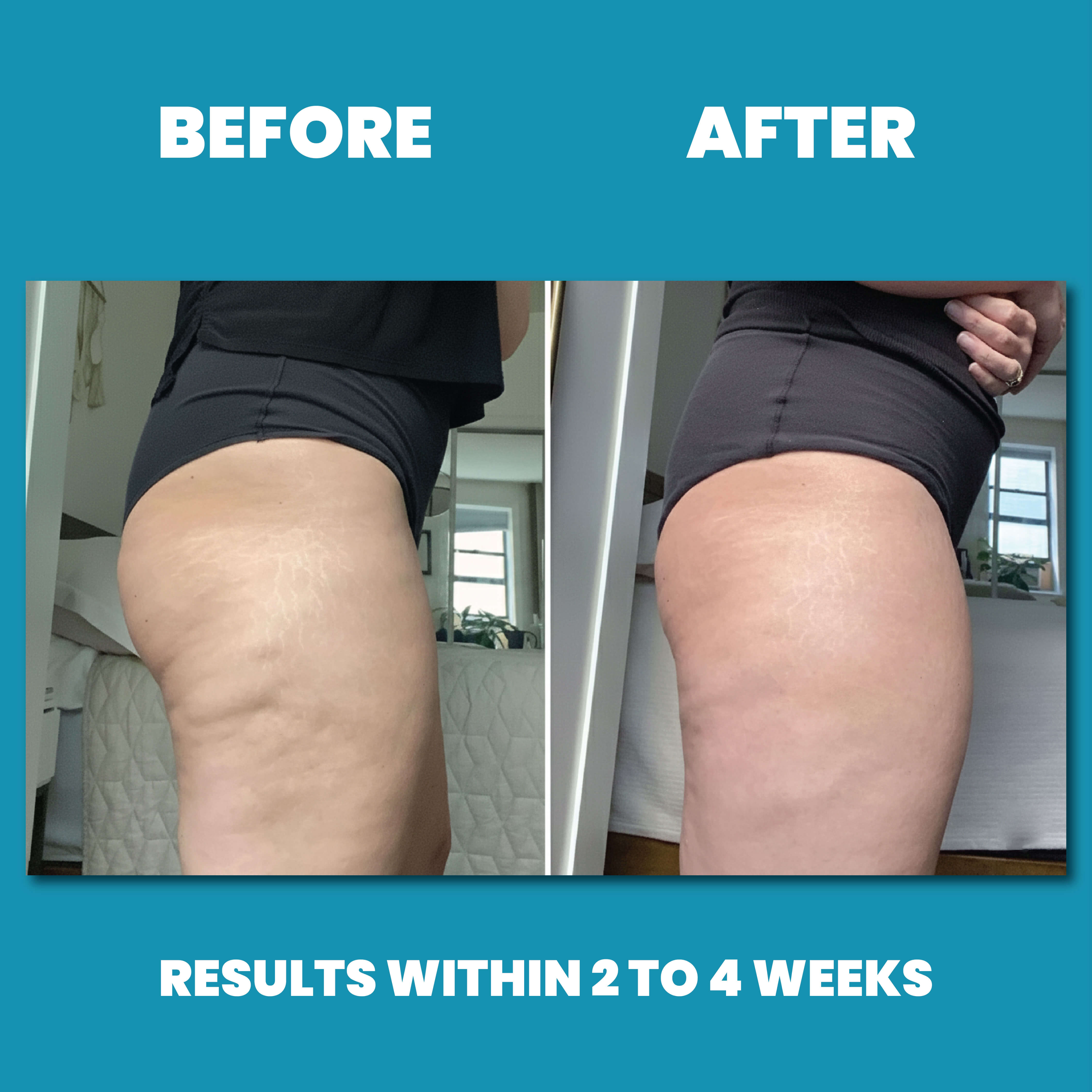 Balmi™ Anti-Cellulite Massage Oil