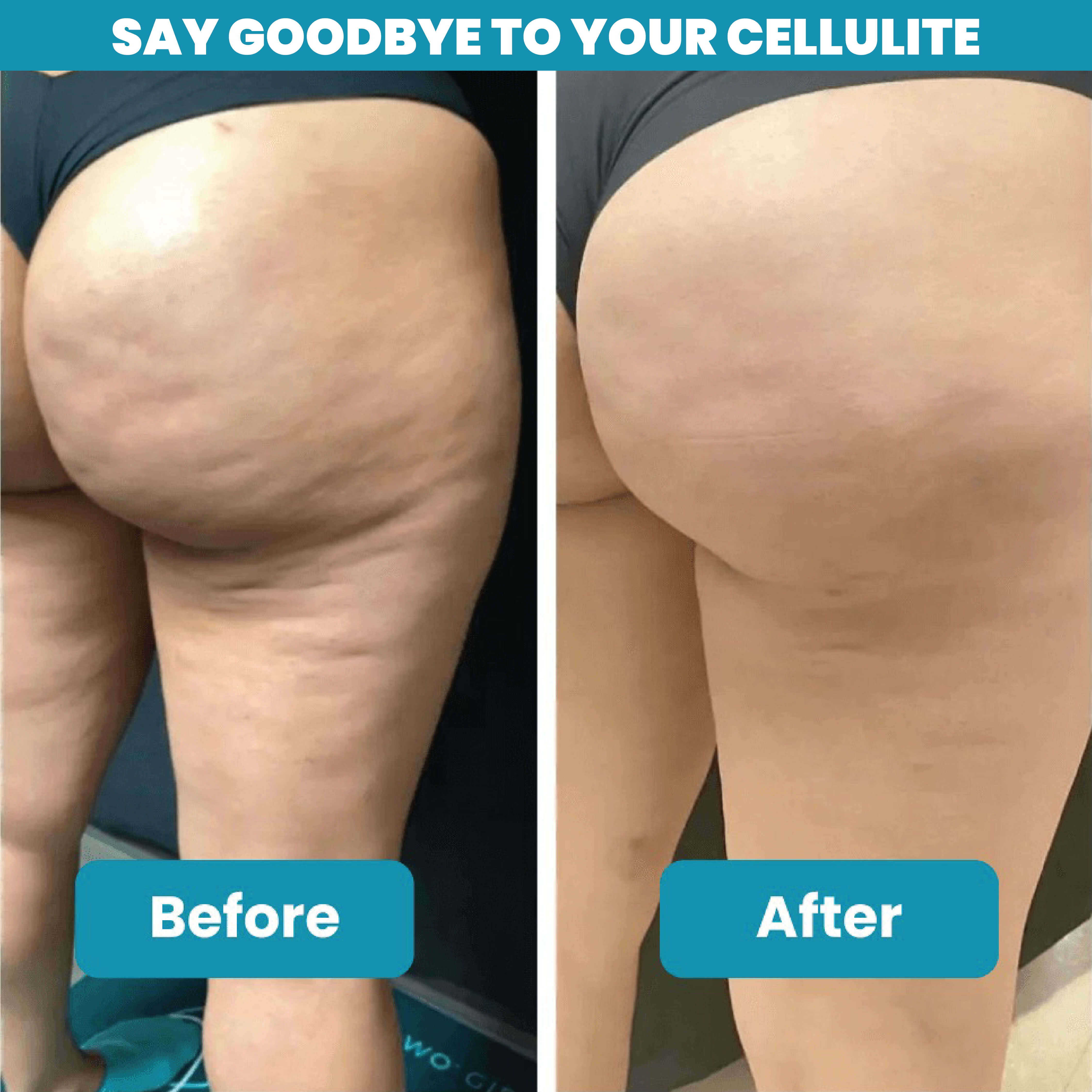 Balmi™ Anti-Cellulite Massage Oil